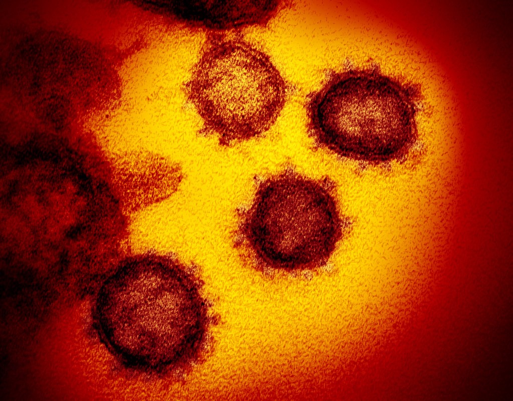 ŠTÚDIA: Koronavírus sa vo vzduchu udrží aj niekoľko hodín