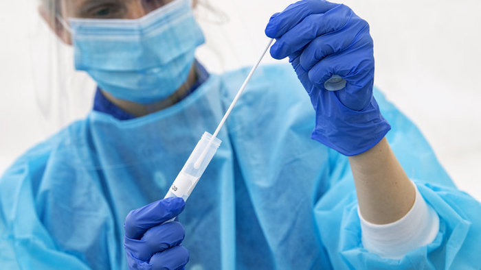 Koronavírus: Po nedeľnom testovaní pribudlo 265 nových infikovaných