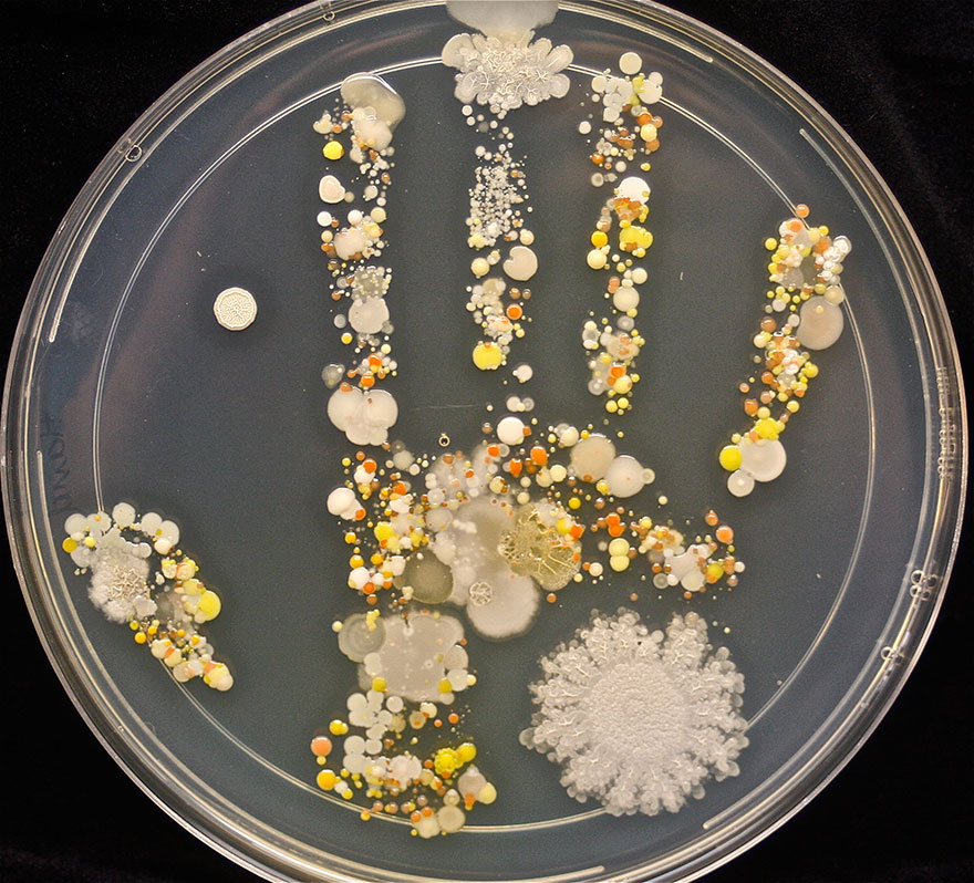 Foto: Takto vyzerá ruka chlapca (8) po hre vonku. Sú tieto baktérie neškodné?