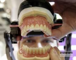 zuby protetika zubny lekar