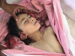 mrtve deti v syrii