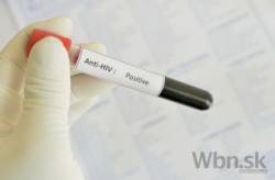 hiv aids krv